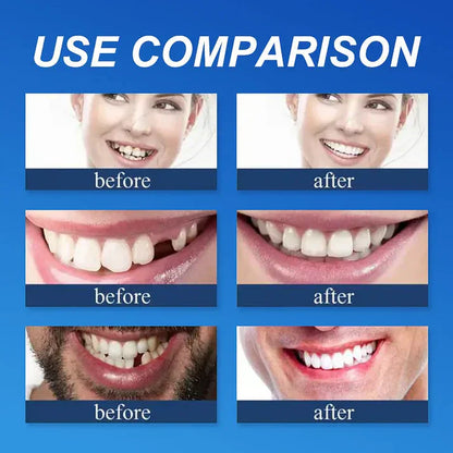 🏆Ends Today: 70% OFF!  🏆2026 Bestselling Product🦷 Fit for a Fresh Smile, Say Goodbye to Wearing Discomfort!🌎