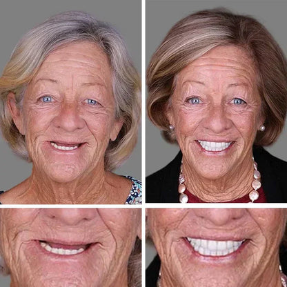 🏆Ends Today: 70% OFF!  🏆2026 Bestselling Product🦷 Fit for a Fresh Smile, Say Goodbye to Wearing Discomfort!🌎