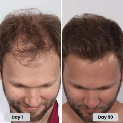 🔥HOT SALE 49% OFF🔥Red light hair growth CAP — Regrow Thicker Hair in 90 Days